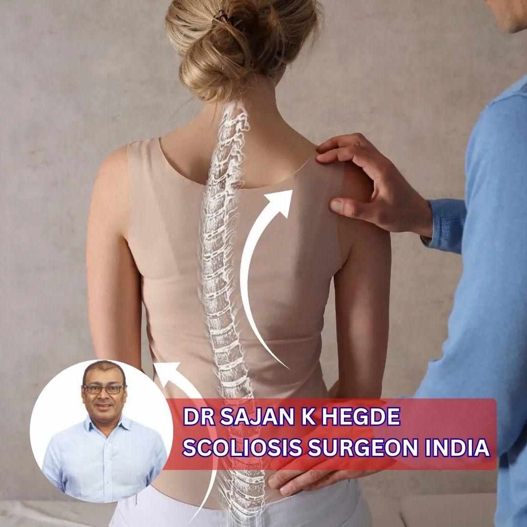 Dr Sajan K Hegde Scoliosis Surgeon India
