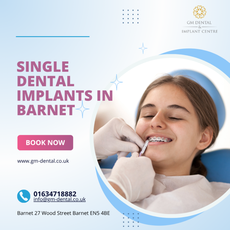 Single Dental Implants In Barnet 768x768