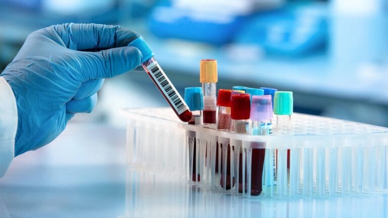 blood testing lab services 768x432