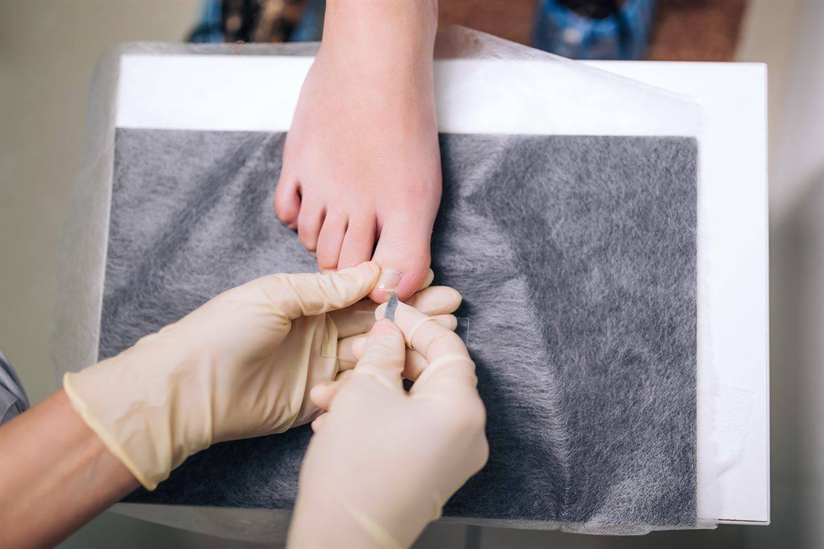 Chiropodists in the UK