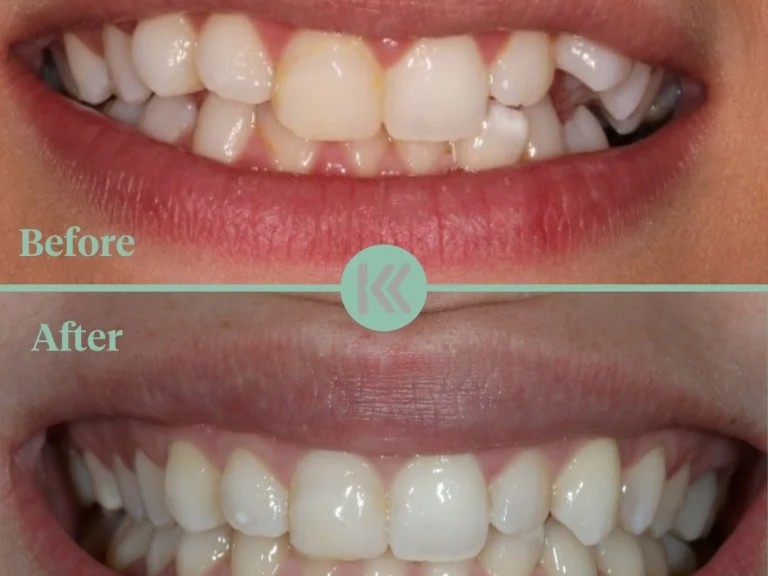 Keppel Advanced Dentistry — photo 3